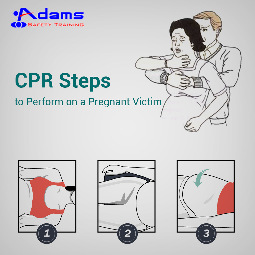 Cpr перевод. CPR is. Двигатель CPR технические характеристики. CPR Speed up.