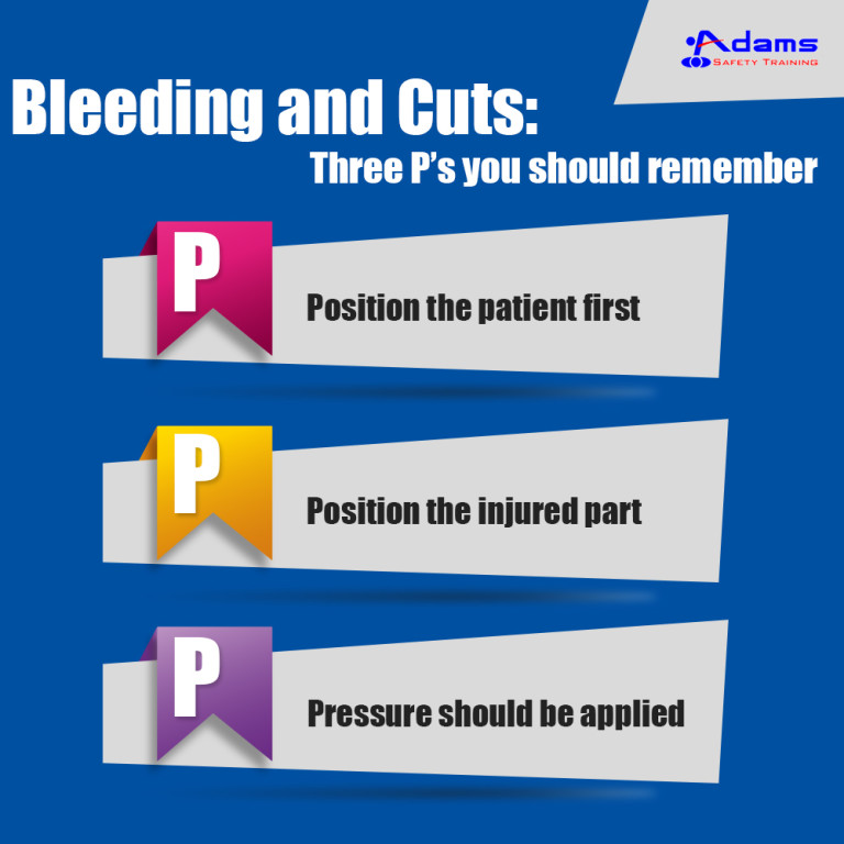 Bleeding and Cuts: Three P’s you should remember
